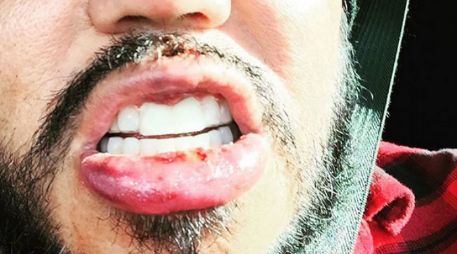 El fundador de Kumbia Kings subió una fotografía a Instagram donde se le ve con una dentadura provisional. INSTAGRAM / @abquintanilla3