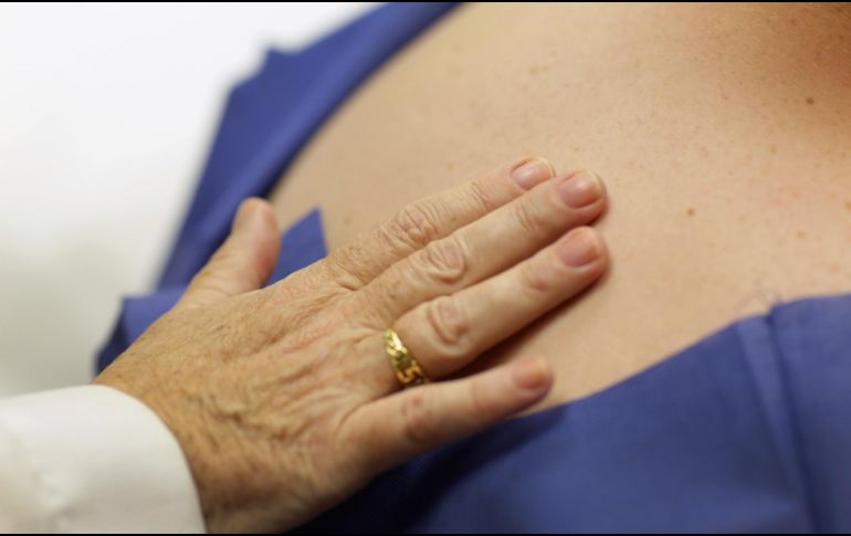 Es importante dar a conocer que esta enfermedad de la piel no es contagiosa. AFP / ARCHIVO