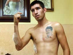 Rafael “Chocho” Guzmán se encuentra estable y recuperándose en su domicilio. E. BARRERA  /