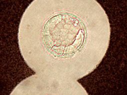 Imagen del hongo 'Cryptococcus neoformans'. EL MUNDO.ES  /