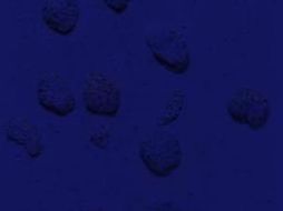 . Klein eligió con precisión obsesiva cada una de las esponjas con las que alteraba el lienzo. EL UNIVERSAL  /