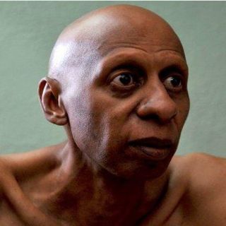 Diagnostican trombosis yugular a Guillermo Fariñas