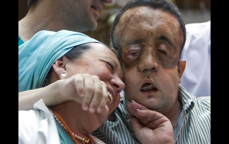 El caso anterior en este tipo de operación fue el de un español llamado Rafael, la operación fue  todo un éxito. ESPECIAL  /