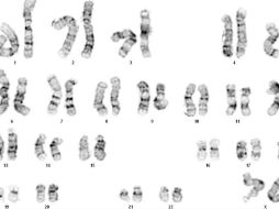 Cariotipo que muestra los pares cromosómicos humanos. ID  /