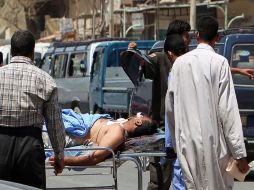 Uno de los 52 heridos que dejó los atentados en Iraq. REUTERS  /