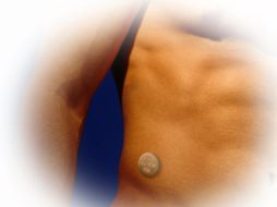 Imagen  donde se aprecia parte del cuerpo de un hombre con un sensor de glucosa implantado en su cuerpo. EFE  /