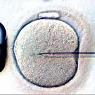 Descubren método para seleccionar espermas en tratamientos 'in vitro'