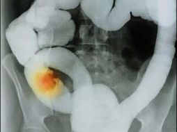 El sedentarismo también forma parte de los factores que causan la enfermedad. ESPECIAL  /