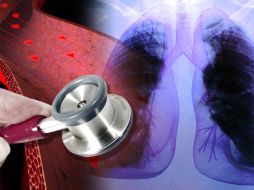 De detectarse alteraciones en el estudio es conveniente que al paciente le sea practicado un cateterismo. ID  /