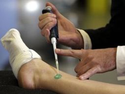 Otros expertos dijeron que el gel luce prometedor. AP  /