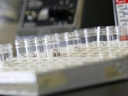 En laboratorios se llevan a cabo investigaciones sobre el virus resistente a los antibióticos. EFE  /