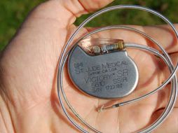 Este dispositivo óptico podría suponer una importante ayuda para los tratamientos cardiológicos. ESPECIAL  /