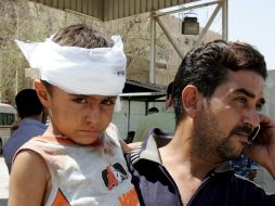 Un niño herido en uno de los atentados de coche-bomba. EFE  /