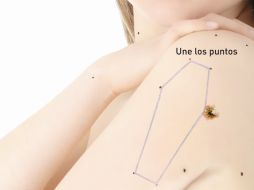 Los cambios de tamaño, color y forma en los lunares, pueden ser una alerta para detectar el cáncer de piel. ESPECIAL  /