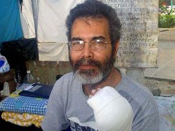 En una de sus protestas Brito se cortó un dedo frente a cámaras de televisón. AFP  /