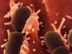 Anteriormente el procedimiento para detectar la bacteria podía durar hasta una semana. ESPECIAL  /