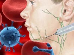 Biopsia de aspiración a un ganglio linfático. ID  /