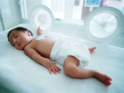 Los bebés prematuros o con bajo peso son los más propensos. ARCHIVO  /