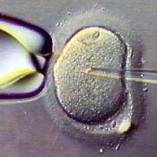 Nuevo sistema aumentaría fecundación in vitro