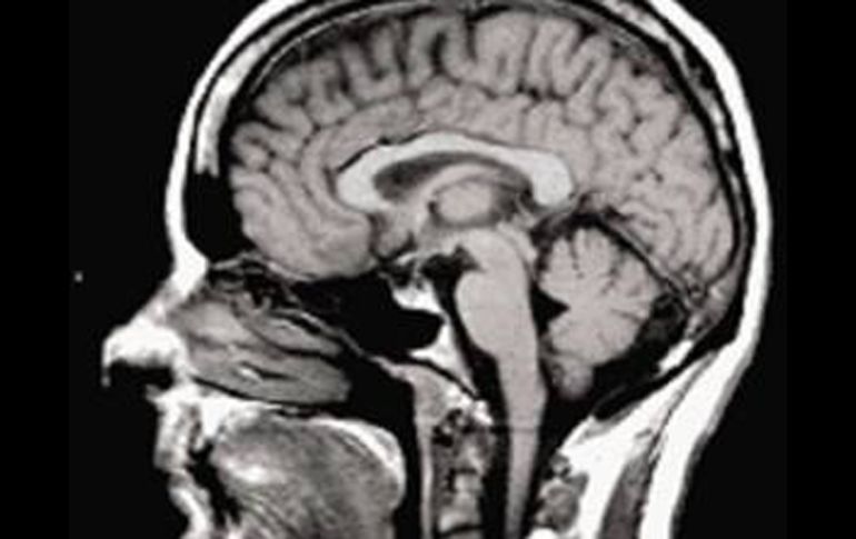 Algunas palabras excitan las mismas partes del cerebro; otras actúan de manera diferente entre el chino y el inglés. EL UNIVERSAL  /