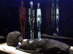 Además apuntaron que no hay nada en el entorno natural que desencadene el padecimiento. AP  /