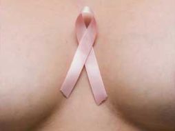 La mayoría de las pacientes son diagnósticadas en etapas avanzadas. WWW.MUJERYCANCER.GALEON.COM  /