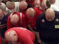 La mayoría de los usuarios del fármaco prefieren tener pelo a dejar el tratamiento. AP  /