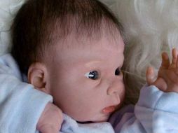 Los médicos recomendaron no utilizar antibióticos de manera temprana. EFE  /