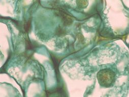 Trabajan en la obtención de los metabolitos honokiol y magnolol a partir de cultivos celulares. ID  /