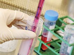 25 compañías tecnológicas diferentes compiten por desarrollar el análisis. AP  /