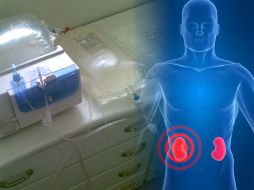 E preciso que el paciente controle sus niveles de glucosa. ID  /