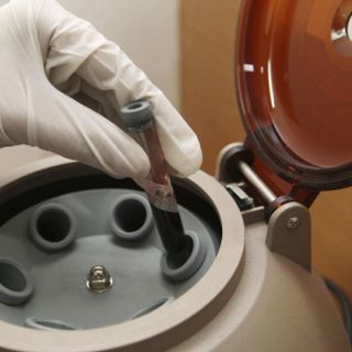 El Sida no es sinónimo de muerte: SSa