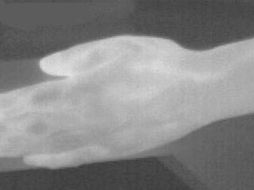 Una imagen de cada par se adquirió antes y la otra después de aplicar la crema. Cortesía: CIO  /