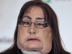 Familiares de Kasper dicen que Culp fue la paciente perfecta para recibir la donación. AP  /