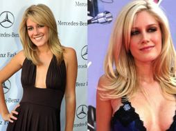 Montag dice que zonas de su cuerpo lucen peor que antes de la cirugía. ESPECIAL  /