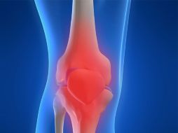 En la actualidad se conocen más de 200 variantes de enfermedades reumáticas. ID  /