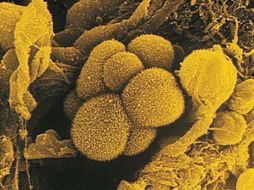 Su peculiaridad es que actúa como pararrayos en las células del cáncer. ESPECIAL  /