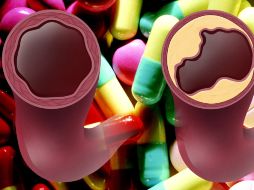 La combinación de ambas sustancias disminuyen los niveles de colesterol en 17 por ciento. ESPECIAL  /