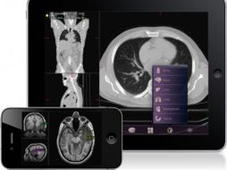 Mobile MIM’reduce las imágenes radiológicas tomadas en un hospital para su transferencia segura a la red y la envía al célular.ESPECIAL  /