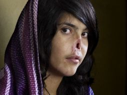 El retrato de Bibi Aisha, una muchacha mutilada de Afganistán, de la periodista Jodi Bieber ganó el World Press Photo 2010. EFE  /