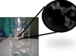 El pie diabético es una infección o ulceración producto de la hiperglucemia. ID  /