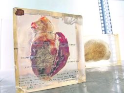 Ya no será necesario extraer órganos para estudiar su anatomía. EL INOFORMADOR  /