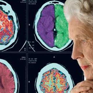 Pesticidas podrían aumentar riesgo de Parkinson