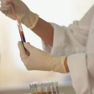 Prueba sanguínea ayudaría a diagnosticar síndrome de Down