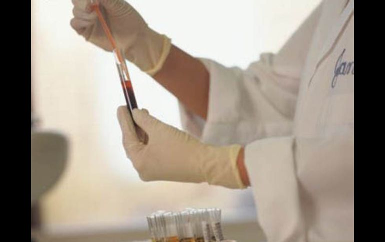 No está disponible todavía una prueba de este tipo en el mercado. ESPECIAL  /