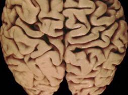 La falta de sueño afecta la capacidad cognitiva del cerebro, según estudio. ID  /