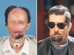 El Ejército busca aprovechar los resultados para ayudar a soldados con heridas graves en la cara. EFE  /