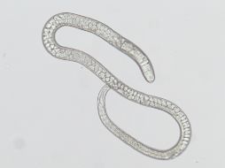 En los humanos comienza a manifestarse por diarrea, malestar estomacal y dolor de ojos. ID  /