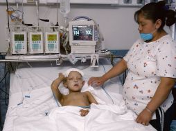 Un menor en tratamiento en el “Juan I. Menchaca”, nosocomio que atiende con quimioterapia a 267 niños. ARCHIVO  /