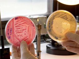 El INS cuenta con la tecnología y capacidad necesaria para poder detectar y tipificar la bacteria E. coli: Perú. EFE  /